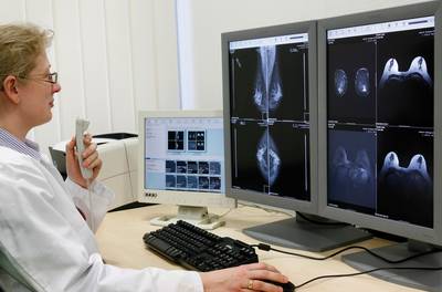 (Digitale) Mammographie