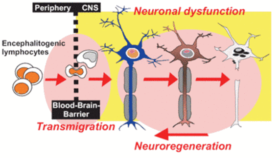 Entzündliche Neurodegeneration und Mechanismen der gestörten Neuroregeneration