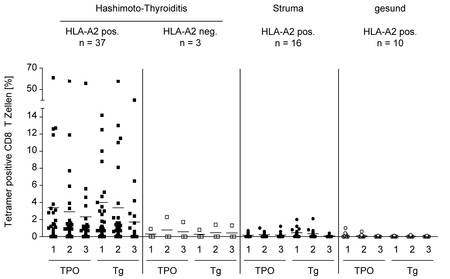Hashimoto Thyroiditis