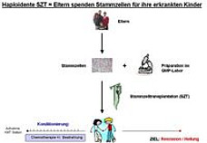 haploidentische Stammzelltransplantation